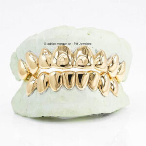 CUSTOM SOLID GOLD GRILLZ SETS