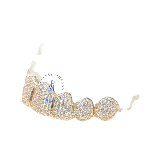 CUSTOM I CLARITY DIAMOND GRILLZ - Image 6