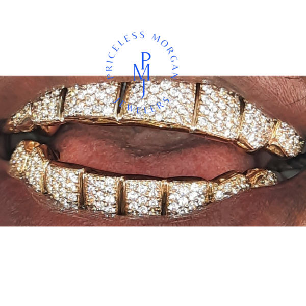 CUSTOM I CLARITY DIAMOND GRILLZ - Image 8