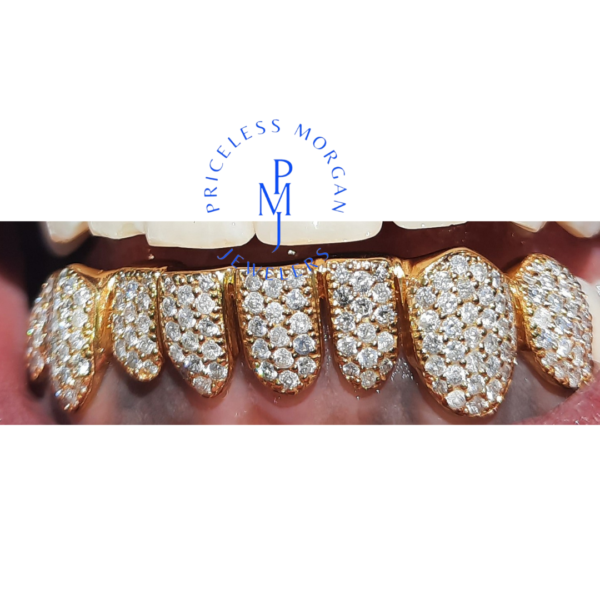 CUSTOM I CLARITY DIAMOND GRILLZ - Image 7