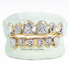 CUSTOM TWO-TONE DIAMOND CUT & DIAMOND DUST W/ SOLID TRIM GOLD GRILLZ