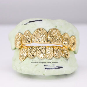 CUSTOM DIAMOND CUT GOLD GRILLZ